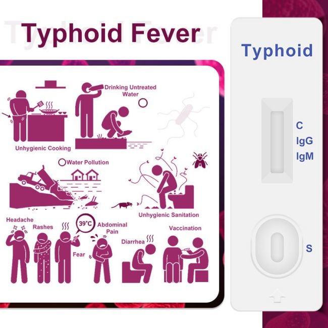 Typhoid IgM / IgG Rapid Antibody Test Cassette One Step 40 Tests/Kit